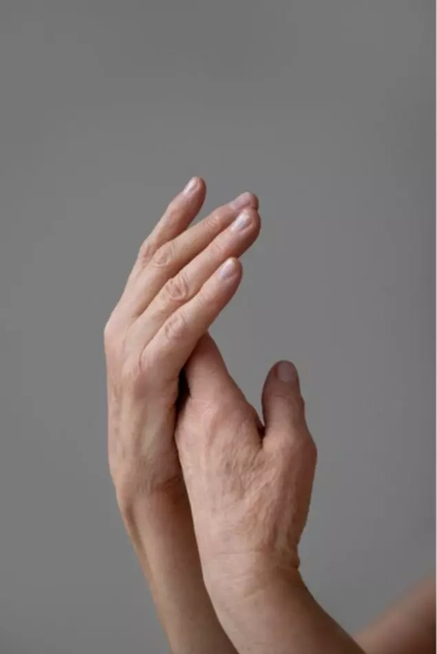 Mãos ressecadas: como cuidar e prevenir esse problema comum