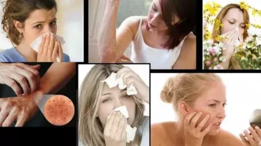 Como Eliminar Alergia ao Calor