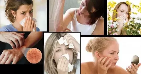 Como Eliminar Alergia ao Calor